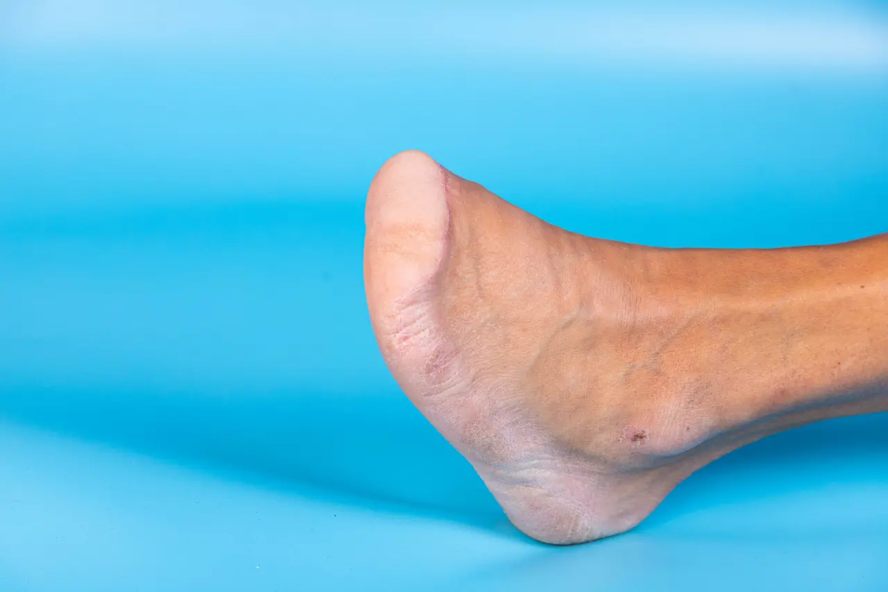 glicemia e colesterol