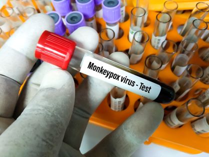 Teste de varíola dos macacos
