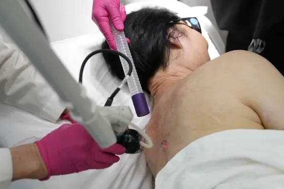 O tratamento de Kim foi feito com terapia a laser para curar e remover o tecido cicatricial.