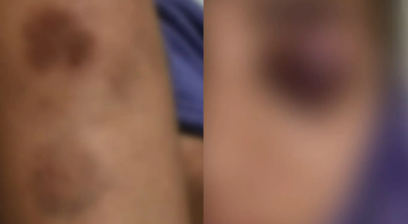 Mulher sofreu mordidas e socos