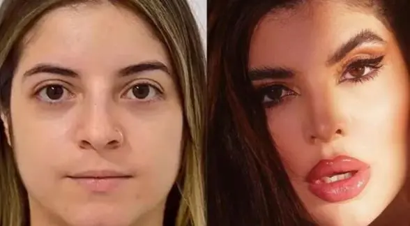 Antes e depois da influenciadora Gkay