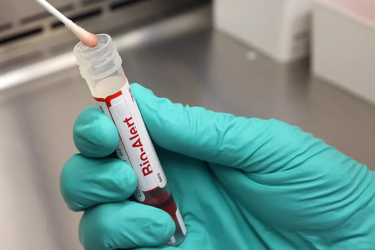 varíola dos macacos