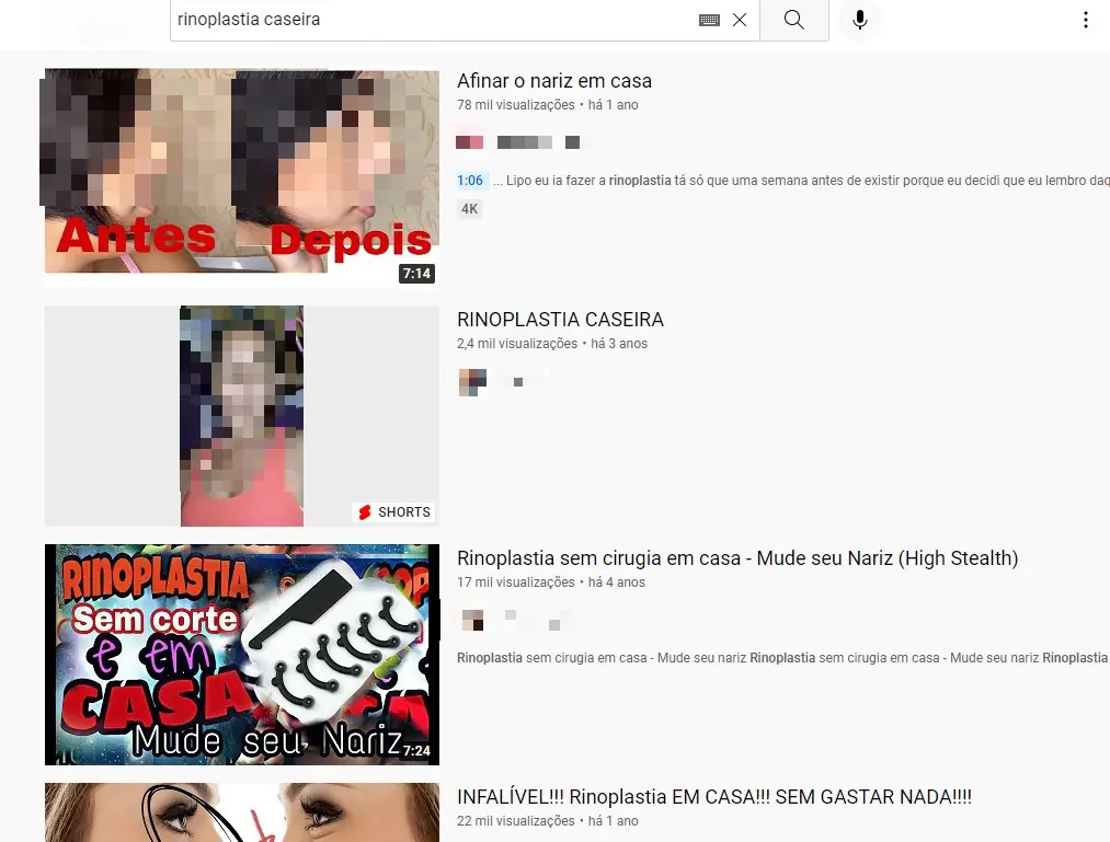 Print de busca no YouTube sobre rinoplastias caseiras.