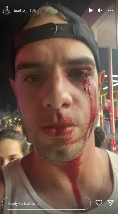 Bruno registrou o próprio rosto após a agressão