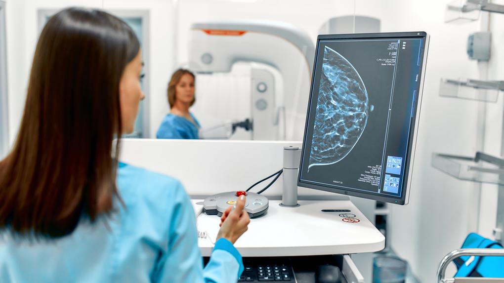 Profissional da saúde atende mulher acima dos 40 anos durante a realização de uma mamografia