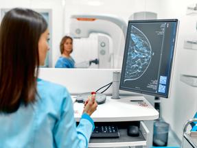 Profissional da saúde atende mulher acima dos 40 anos durante a realização de uma mamografia