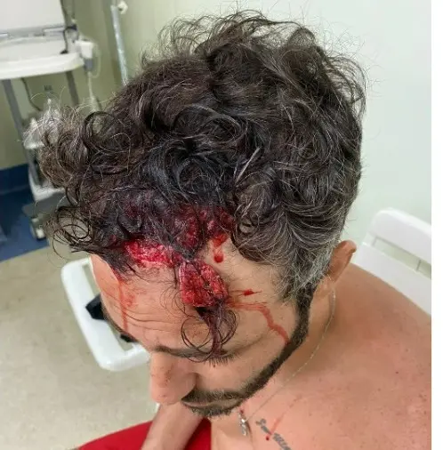 Agressão de Thiago Rodrigues