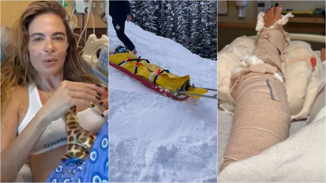 montagem com fotos de luciana gimenez no hospital, frame de vídeo de resgate e imagem da perna fraturada