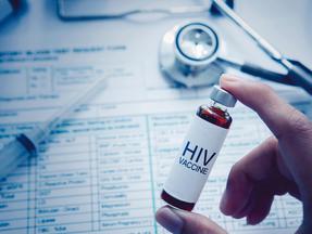 Vacina HIV