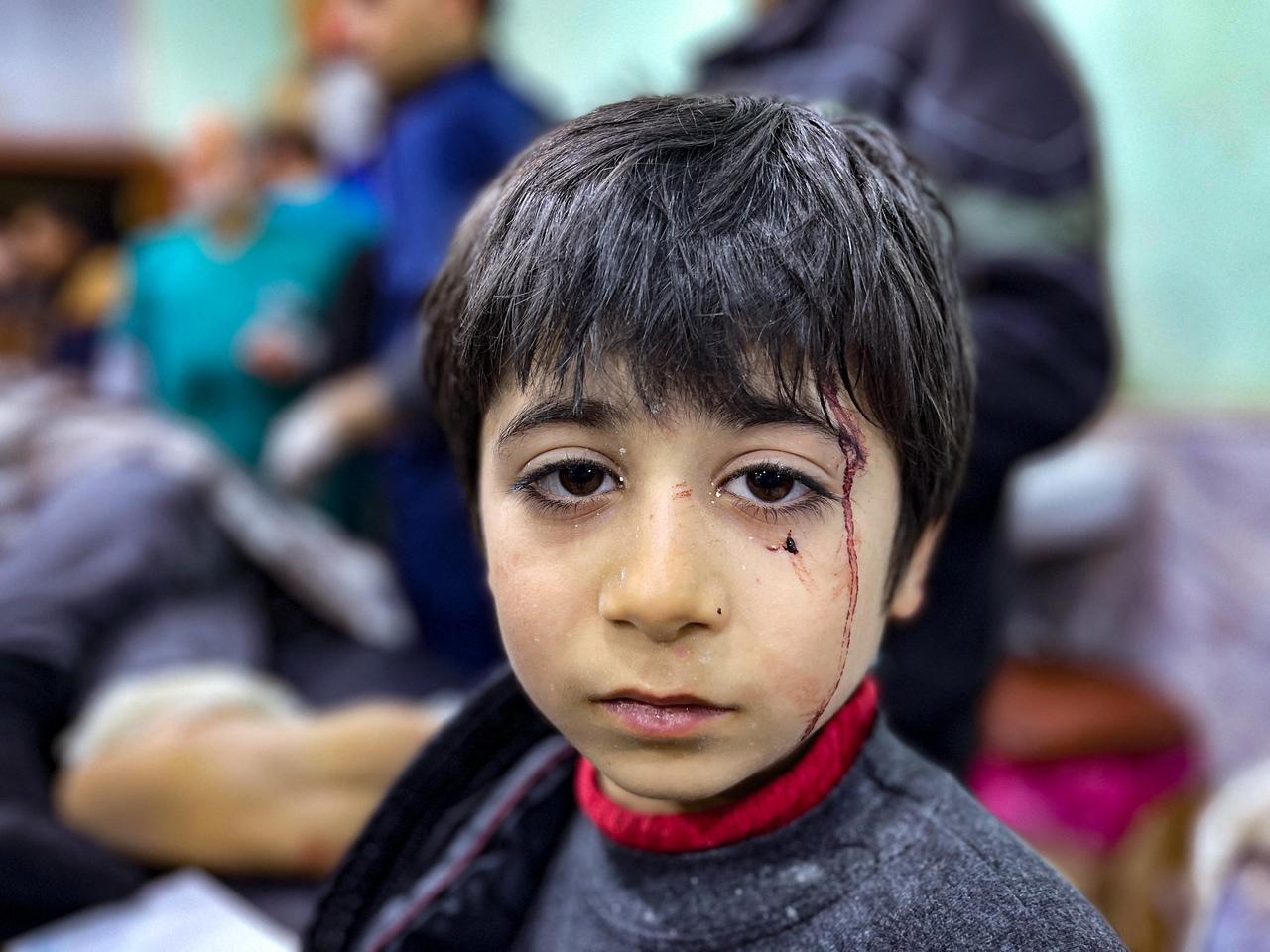 Uma criança ferida aguarda tratamento no hospital Bab al-Hawa após um terremoto, na zona rural do norte da província de Idlib, na Síria, controlada pelos rebeldes, na fronteira com a Turquia, no início de 6 de fevereiro de 2023