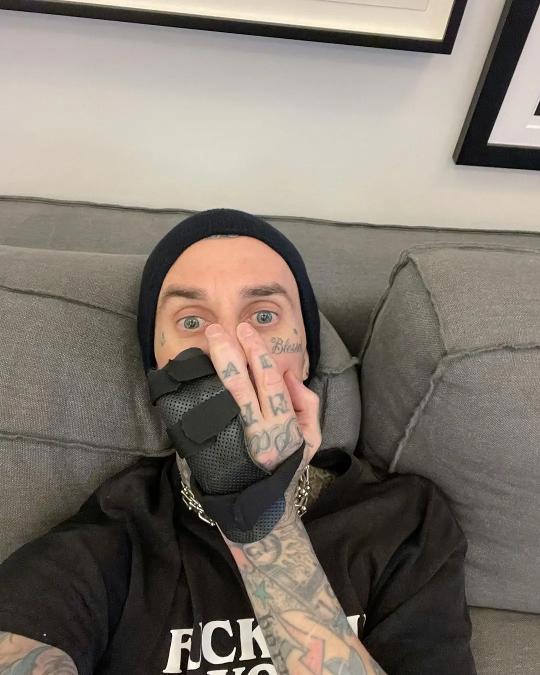 Imagem da notícia: Travis Barker, do Blink-182, passa por cirurgia após lesionar dedo em ensaio