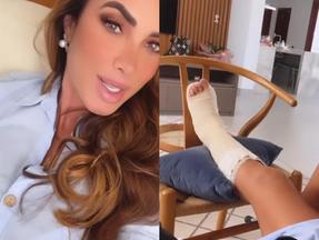 Captura de tela de Nicole Bahls no Instagram avisando que vai fazer uma cirurgia no pé