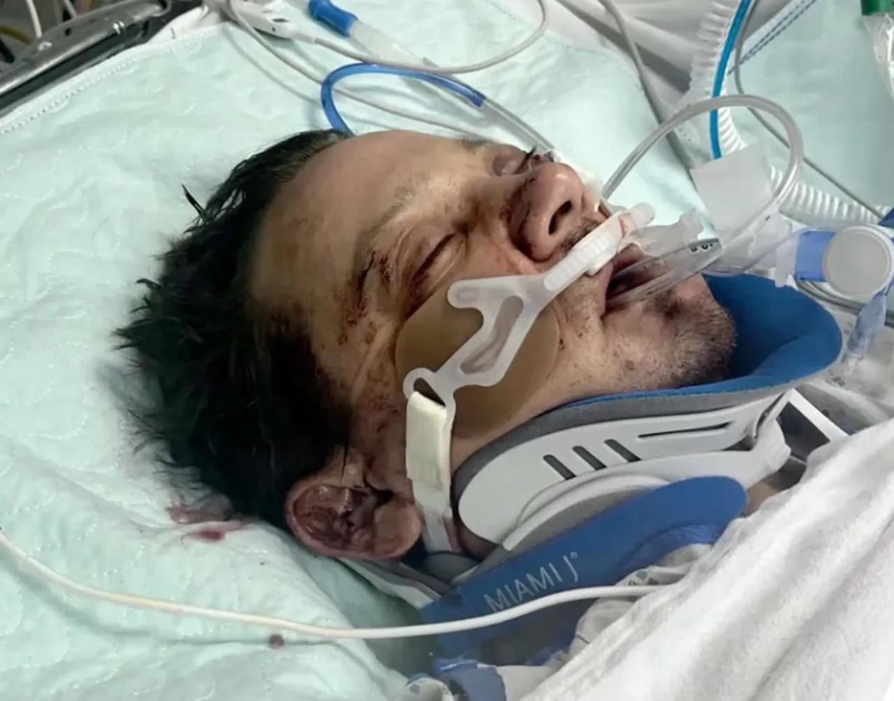 Jeremy Renner no hospital após máquina de remover gelo o esmagar