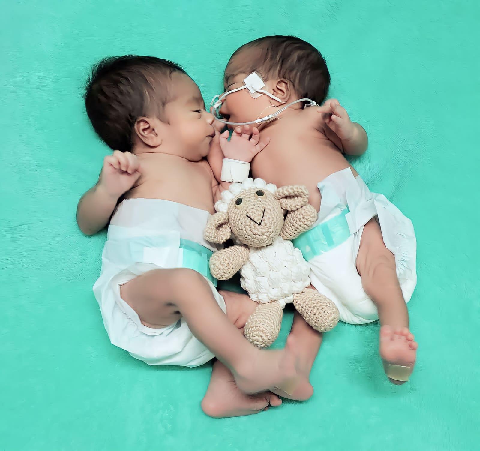 Bebês durante ensaio fotográfico especial de Páscoa em hospital de Sobral