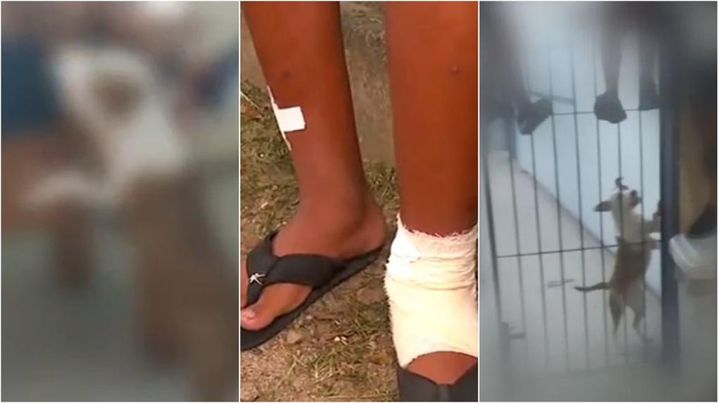 Aluno é mordido na perna por pitbull em escola, no Rio de Janeiro