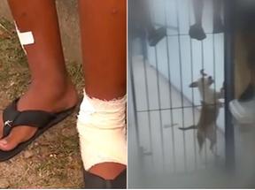 Aluno é mordido na perna por pitbull em escola, no Rio de Janeiro