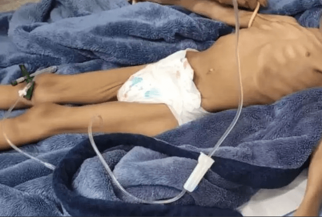 Criança desnutrida, São Paulo, conselho tutelar