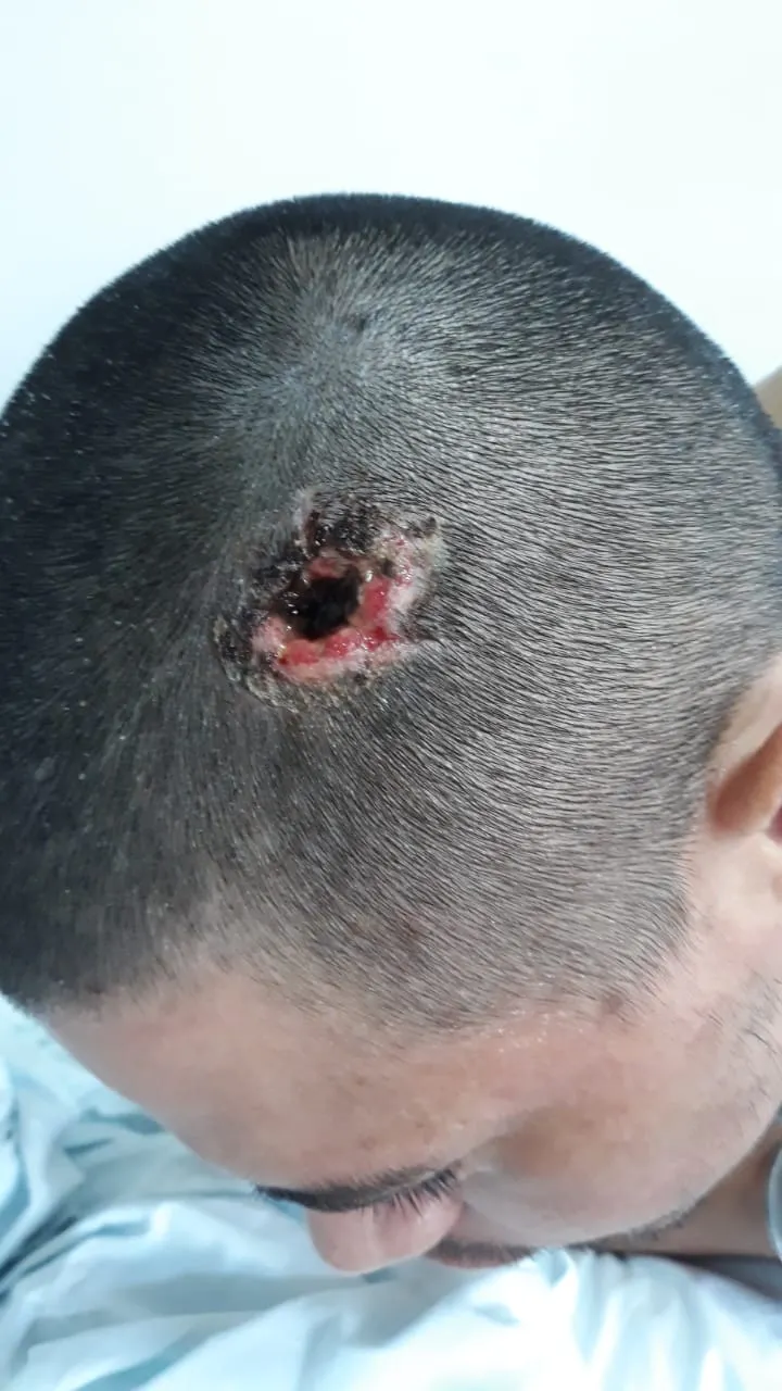 Vítima foi atingida na cabeça