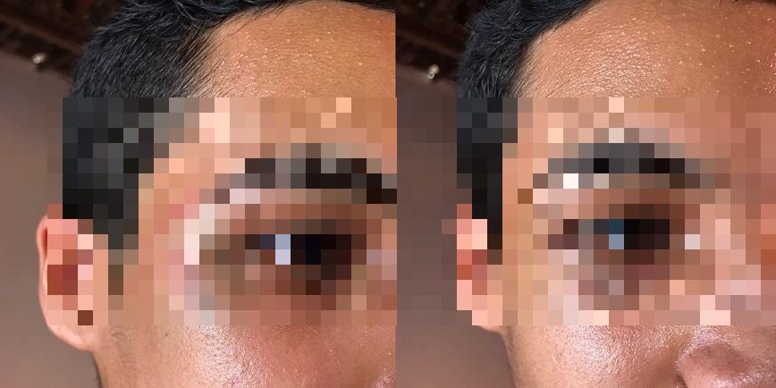 Jovem agredido em escola municipal de Fortaleza