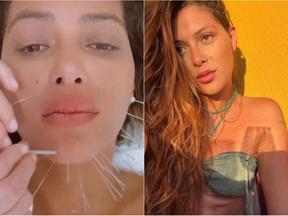 Montagem de fotos mostra, à esquerda, Marcella Maia tratando a paralisia facial. À direita, uma foto do arquivo pessoal da atriz em que ela está de biquíni