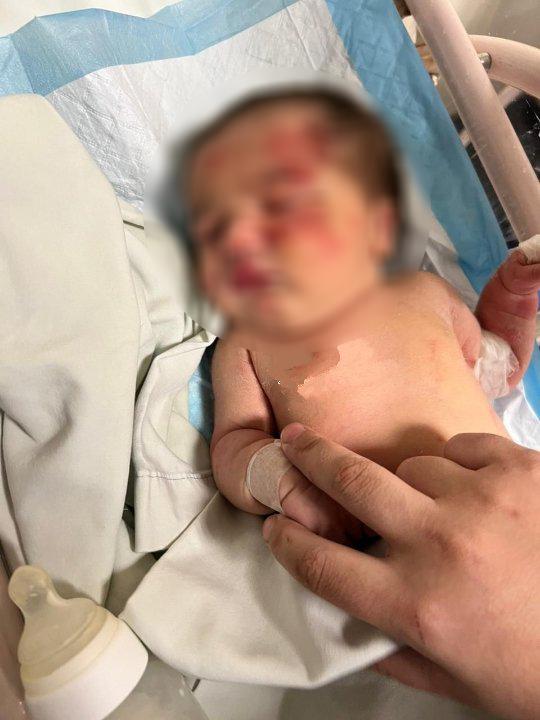 Bebê encontrada na rua