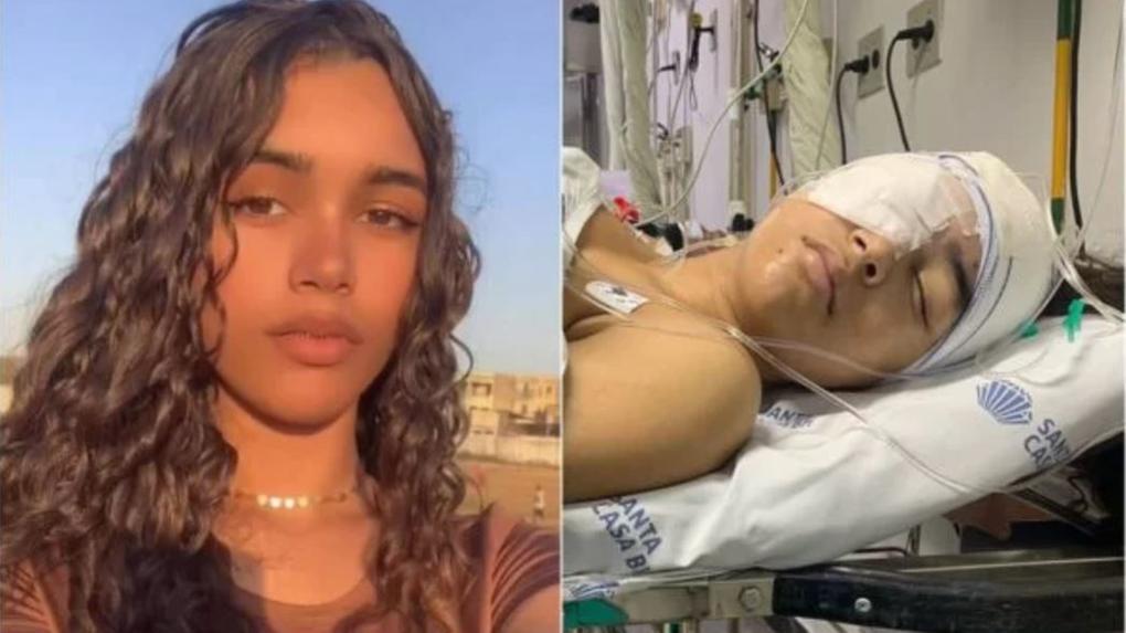 adolescente Gabrielle Monteiro Sousa, de 16 anos, quase perdeu a visão em decorrência de uma sinusite bacteriana mal curada