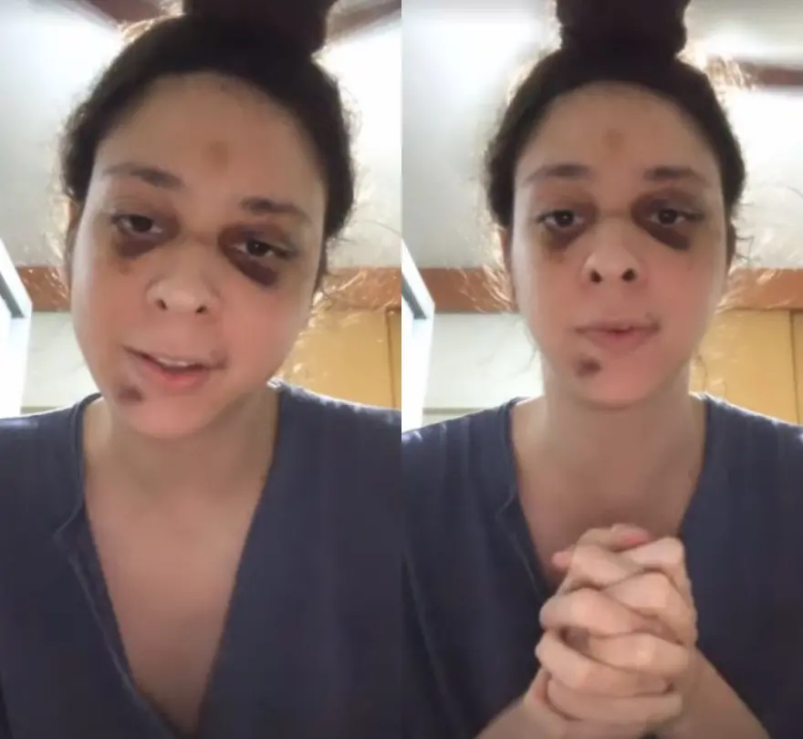 Victor Meyniel foi agredido em Copacabana no último sábado (2)