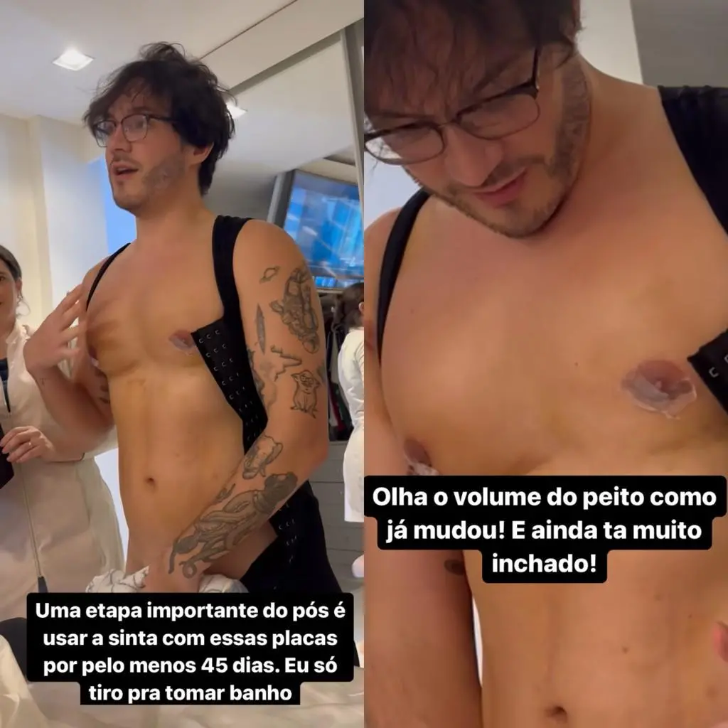 Eliezer pós-operatório