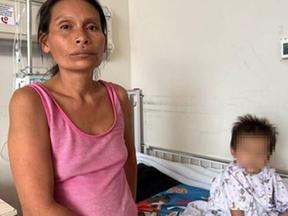 Criança de dois anos passou por cirurgia de emergência após engolir agulhas enquanto brincava no Peru