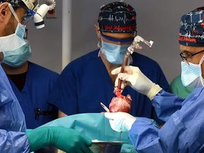 Médicos fazem o transplante de coração de um porco para um humano