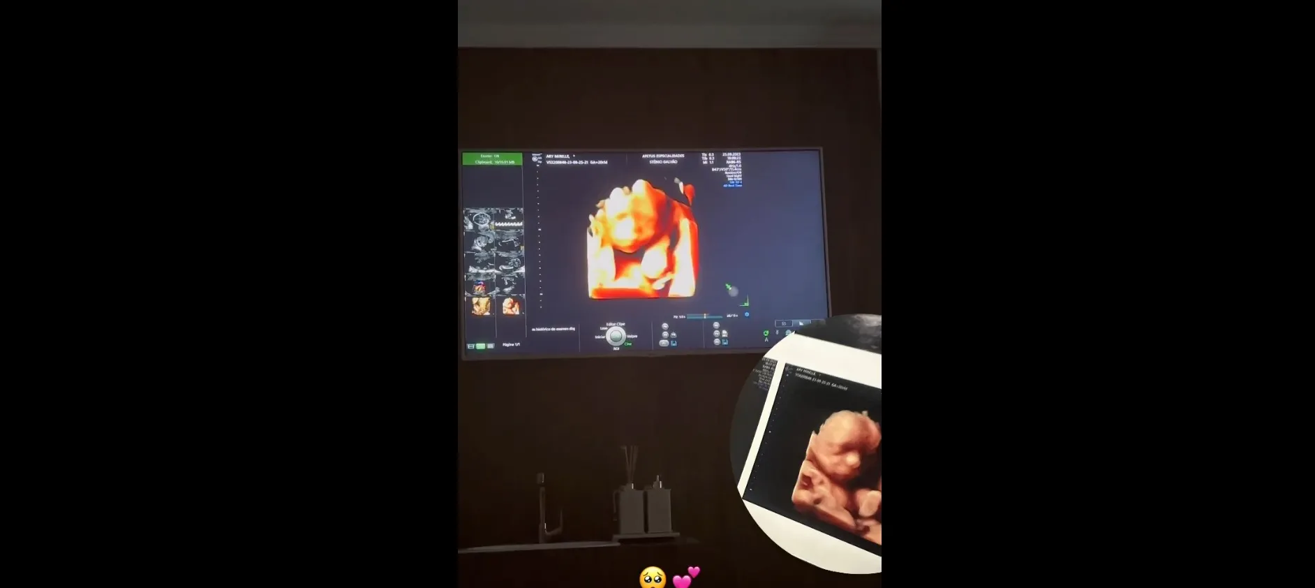 Ultrassom em 4D de Jorge, primeiro filho de João Gomes e Ary Mirelle