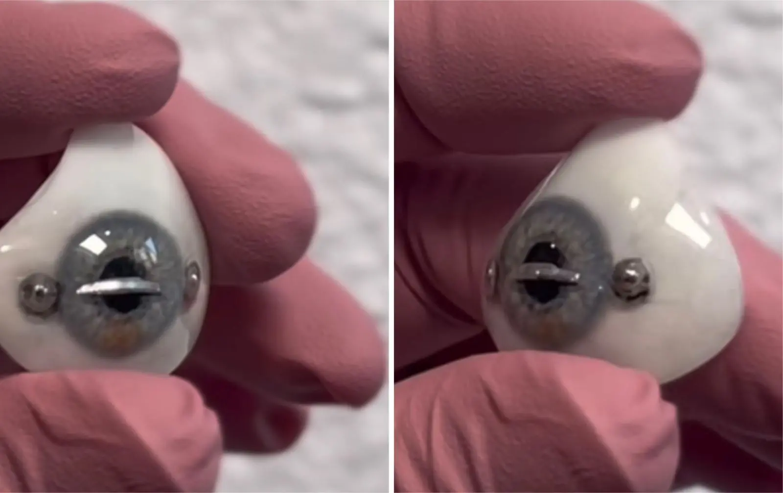 Montagem de fotos mostra pessoa segurando prótese de olho