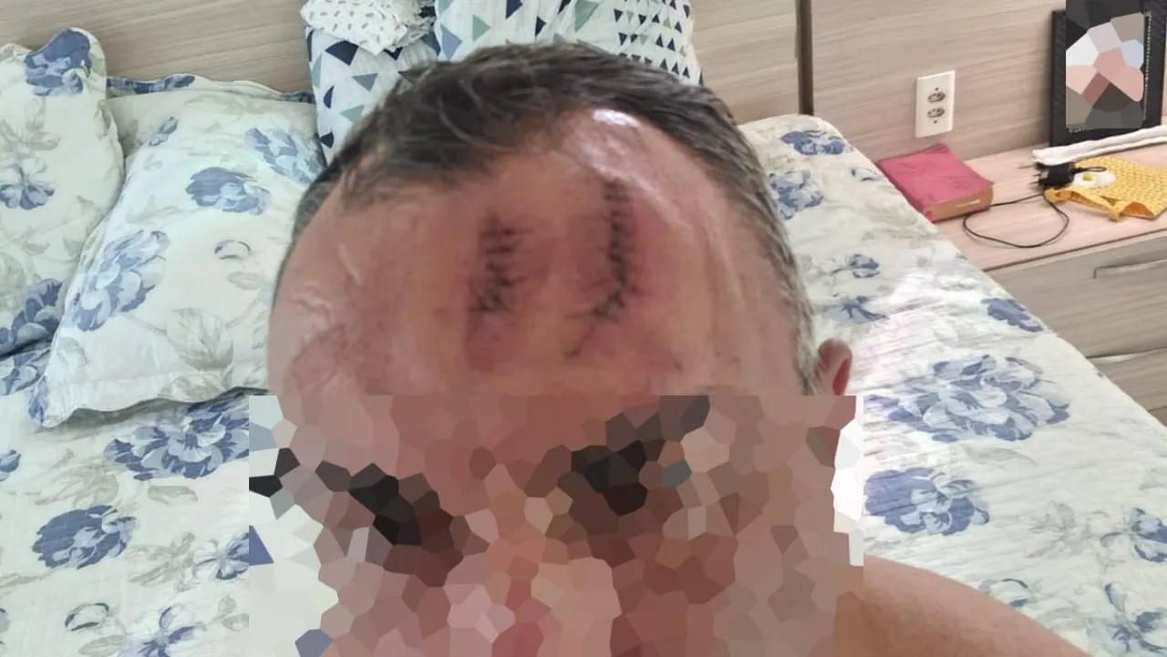 Vítima de tentativa de sequestro e assalto em Maracanaú