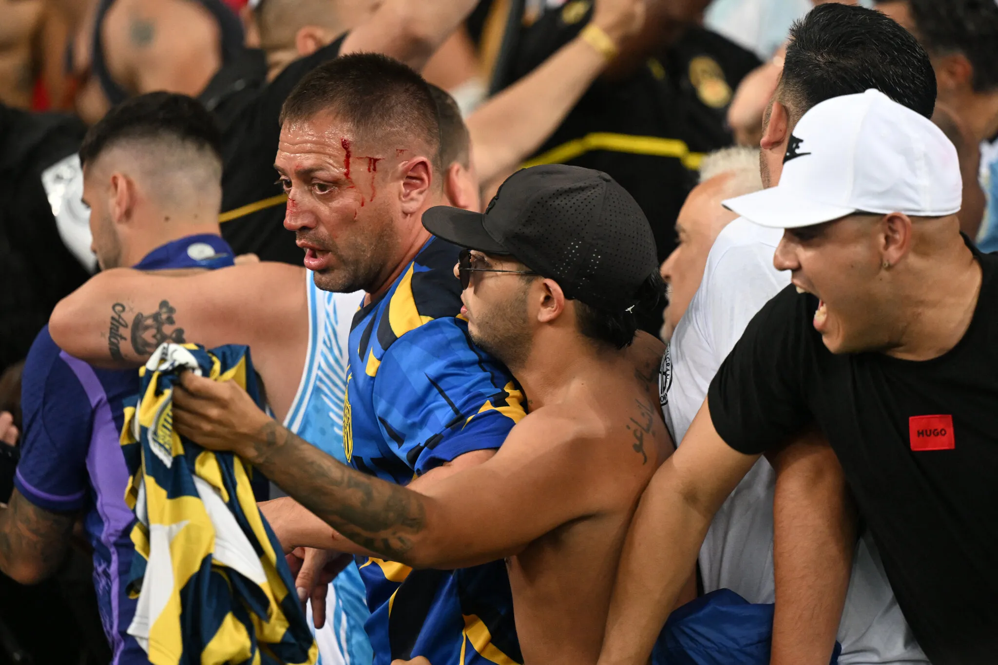 Torcedores argentinos foram feridos na confusão.