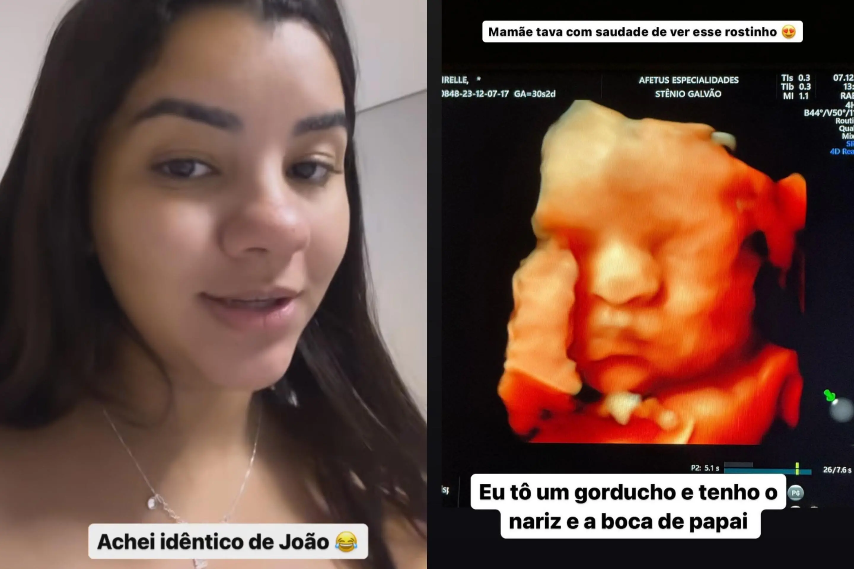 Ary achou filho bochechudo