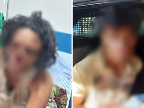 Marido tenta arrancar nariz da mulher e é indiciado por tentativa de feminicídio em Tocantins