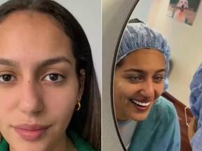 Montagem mostra antes e depois de brasileira que mudou cor dos olhos com cirurgia. Queratopigmentação: saiba o que é e quais riscos de cirurgia que muda cor dos olhos
