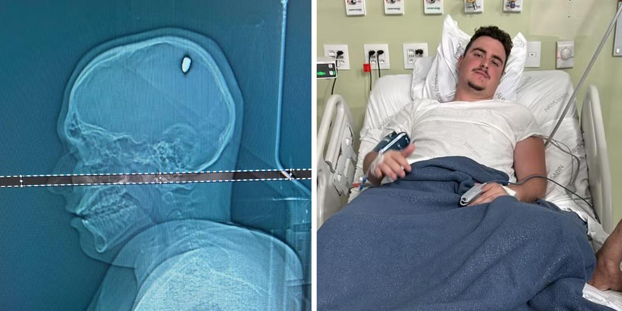 foto de Mateus Facio, jovem que foi atingido por tiro na cabeça e descobriu 4 dias depois