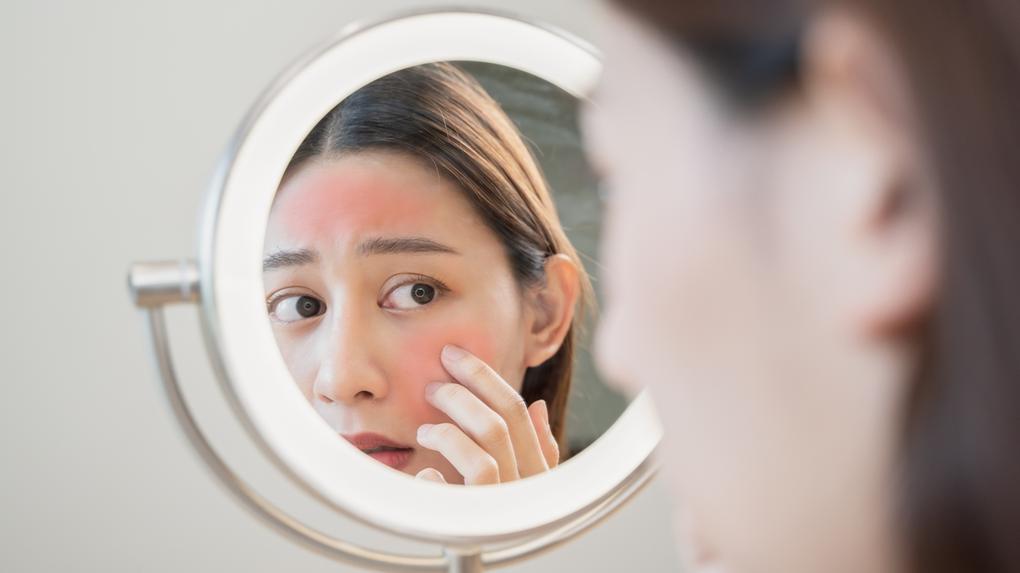 Uma jovem asiática que olha a pele do rosto no espelho tem uma erupção vermelha no rosto devido a alergia cosmética. Adolescente de 13 anos quase perde a visão após seguir tutorial de skin care do TikTok