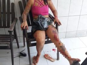 O caso envolveu uma amiga da suspeita e aconteceu no município de Abreu e Lima, no Grande Recife