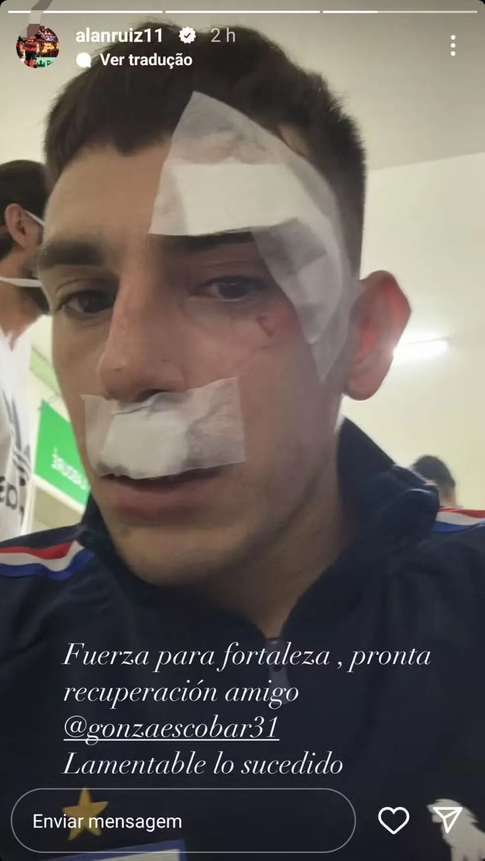 Escobar foi um dos atletas mais atingidos pelo ataque sofrido.
