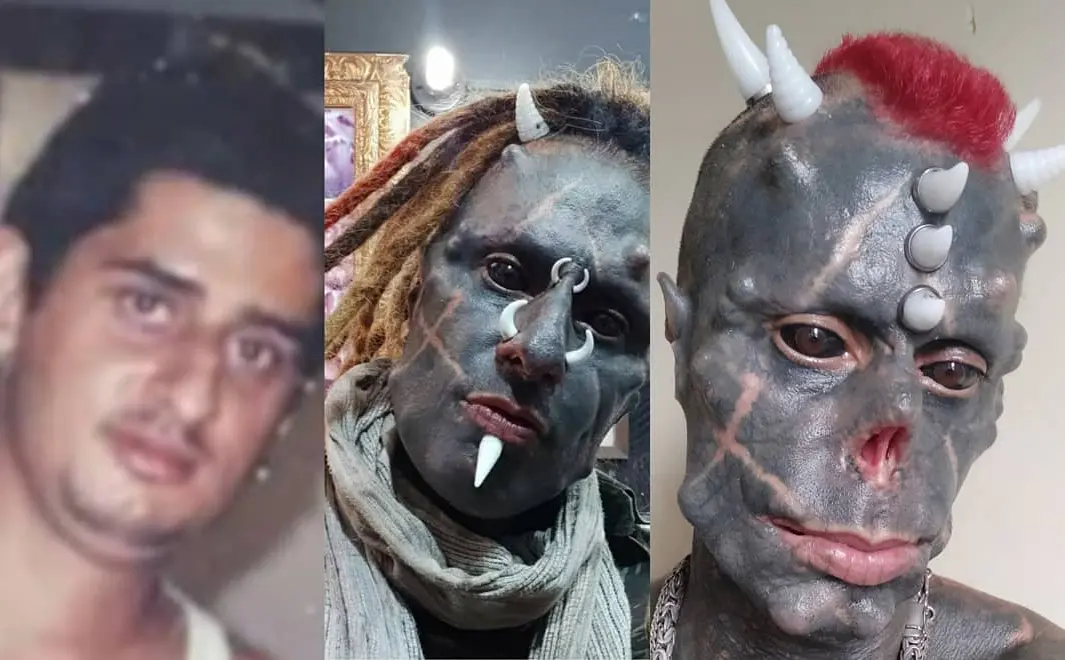 Diabão fez diversas cirurgias