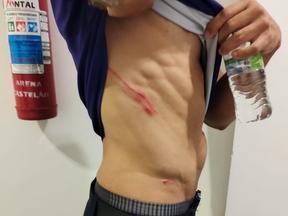 Imagem mostra homem ferido