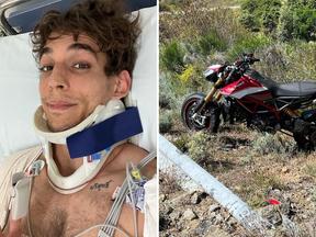 Ator Miguel Herrán sofreu uma luxação na clavícula após acidente de moto