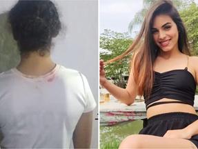 Montagem de fotos mostra à esquerda a suspeita de costas e cabelo amarrado e à direita a vítima