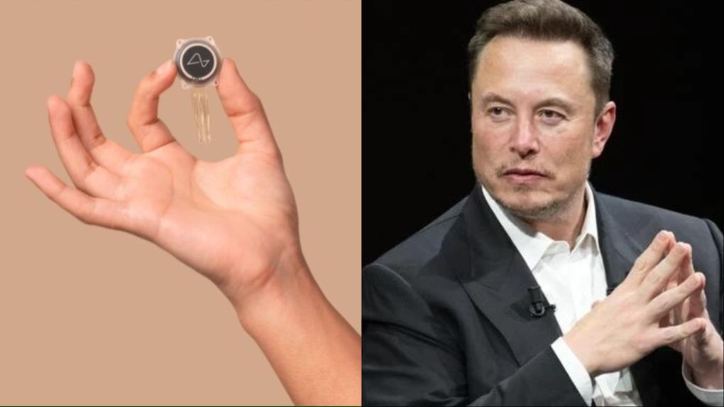 Empresa de Elon Musk, Neuralink está fazendo os primeiros testes de dispositivo cerebral em humanos