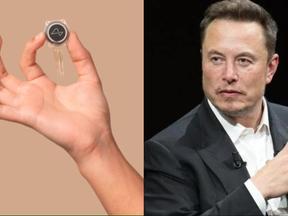 Empresa de Elon Musk, Neuralink está fazendo os primeiros testes de dispositivo cerebral em humanos