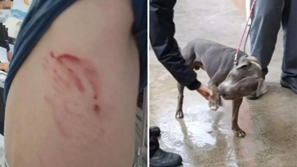 Montagem de fotos mostra corpo de menino ferido à esquerda e pitbull à direita