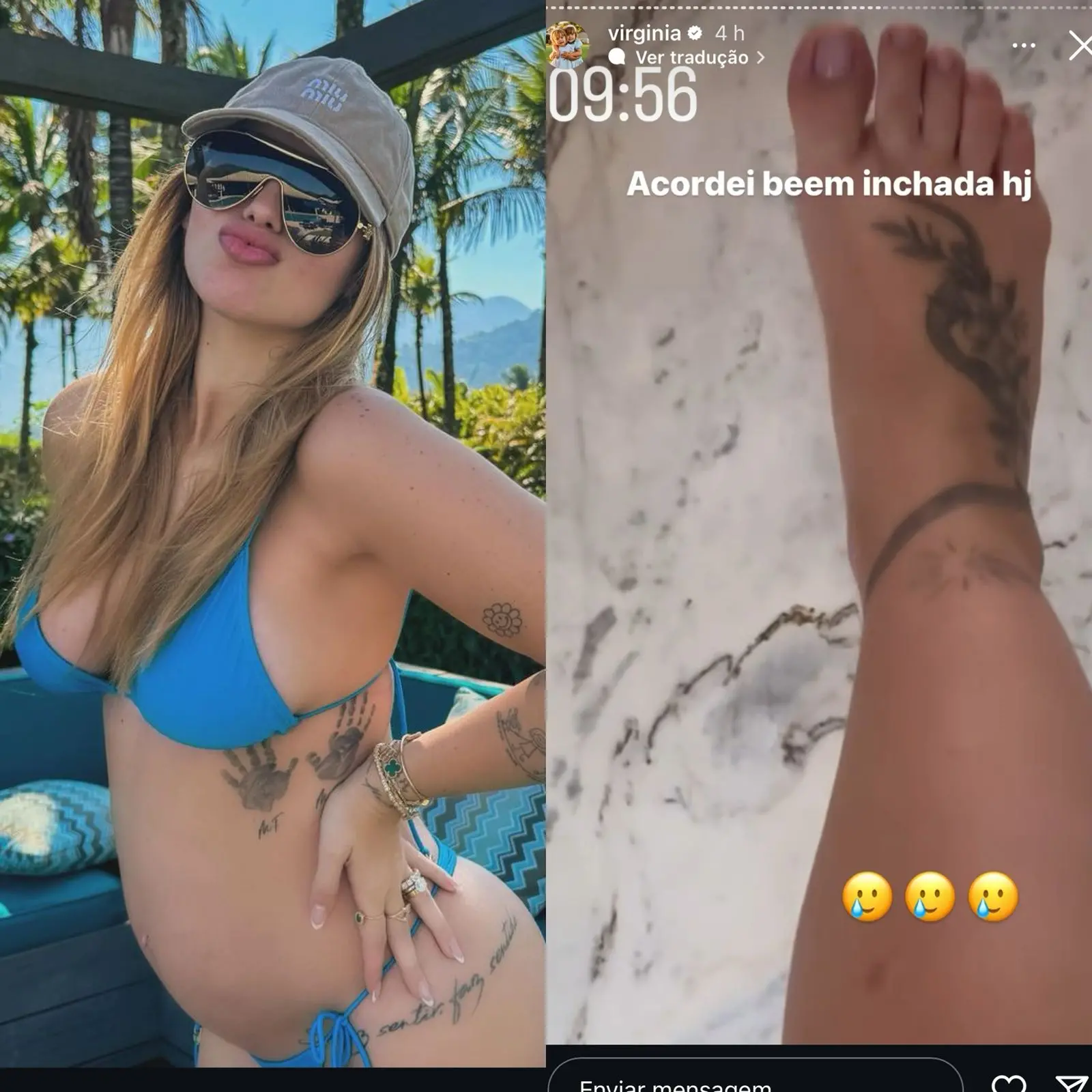 Virgínia exibiu os pés inchados na internet