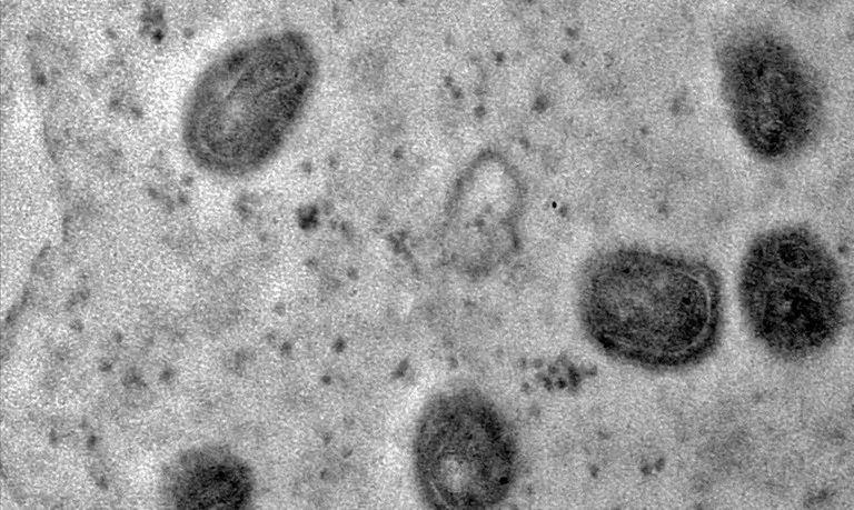 Em 14 de agosto de 2024 a Organização Mundial da Saúde (OMS) declarou a Mpox como emergência sanitária global